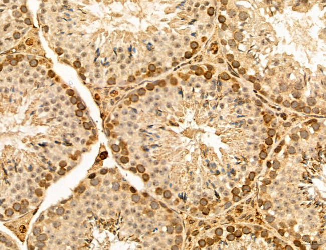 LARS2 Antibody in Immunohistochemistry (Paraffin) (IHC (P))