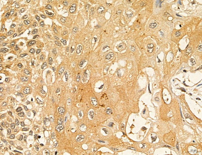 LARS2 Antibody in Immunohistochemistry (Paraffin) (IHC (P))