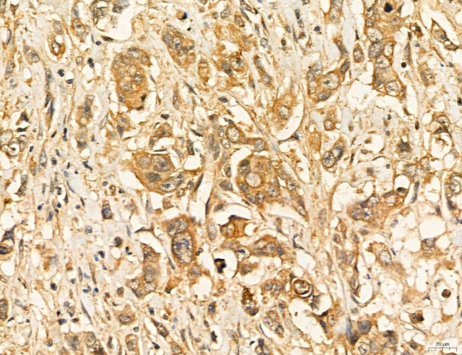 LARS2 Antibody in Immunohistochemistry (Paraffin) (IHC (P))