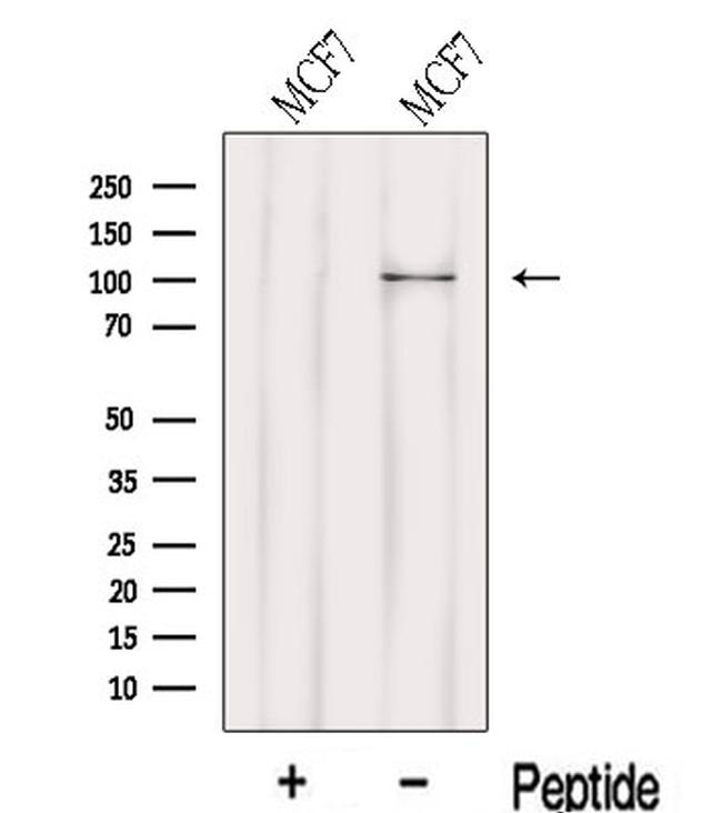 LARS2 Antibody in Western Blot (WB)