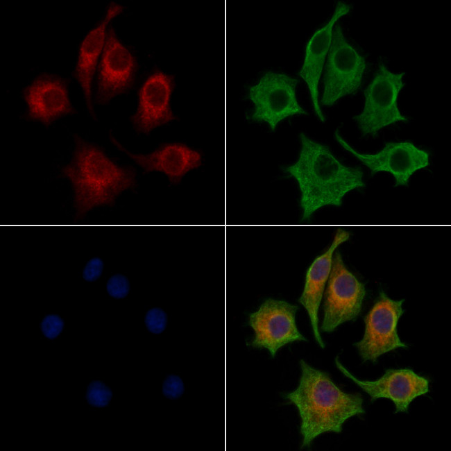 Lass2 Antibody in Immunocytochemistry (ICC/IF)