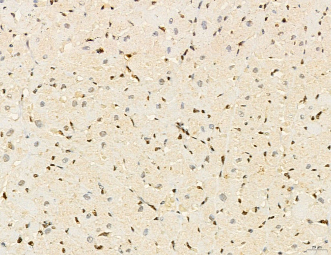 Lass2 Antibody in Immunohistochemistry (Paraffin) (IHC (P))