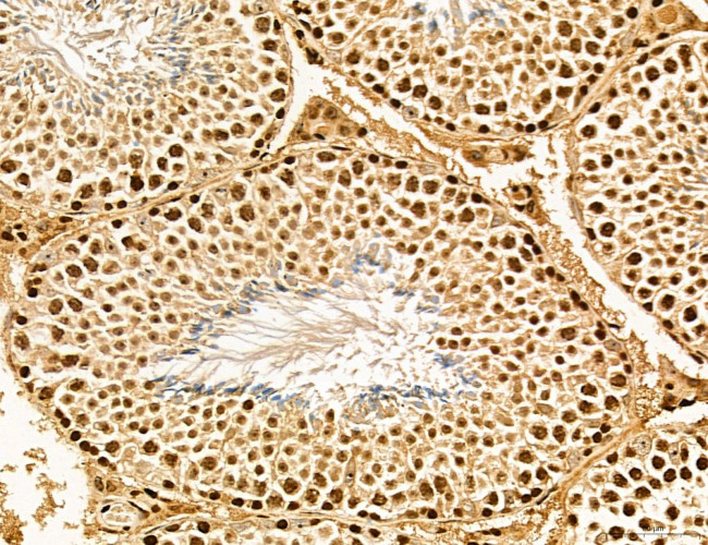 Lass2 Antibody in Immunohistochemistry (Paraffin) (IHC (P))