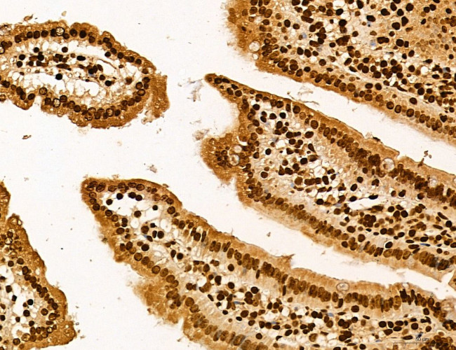 Lass2 Antibody in Immunohistochemistry (Paraffin) (IHC (P))