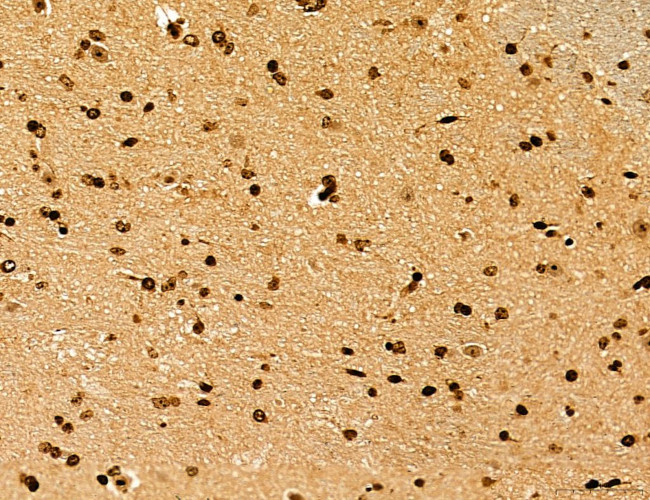 Lass2 Antibody in Immunohistochemistry (Paraffin) (IHC (P))