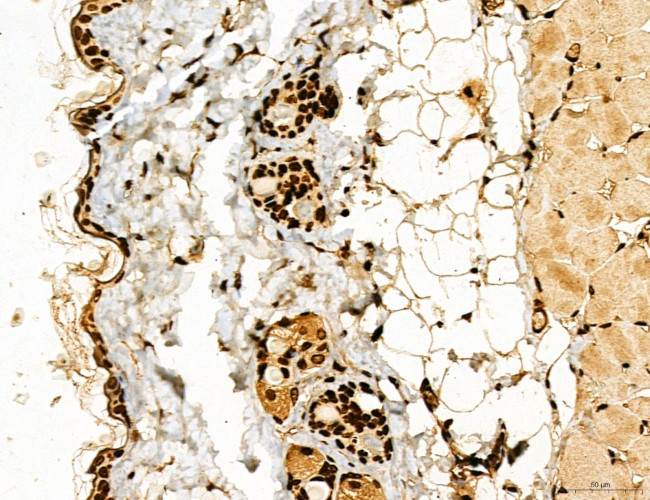 Lass2 Antibody in Immunohistochemistry (Paraffin) (IHC (P))