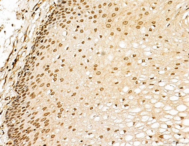 Lass2 Antibody in Immunohistochemistry (Paraffin) (IHC (P))