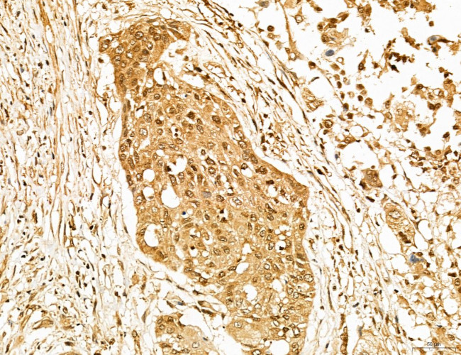 Lass2 Antibody in Immunohistochemistry (Paraffin) (IHC (P))