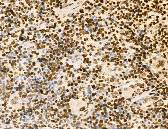 Lass2 Antibody in Immunohistochemistry (Paraffin) (IHC (P))