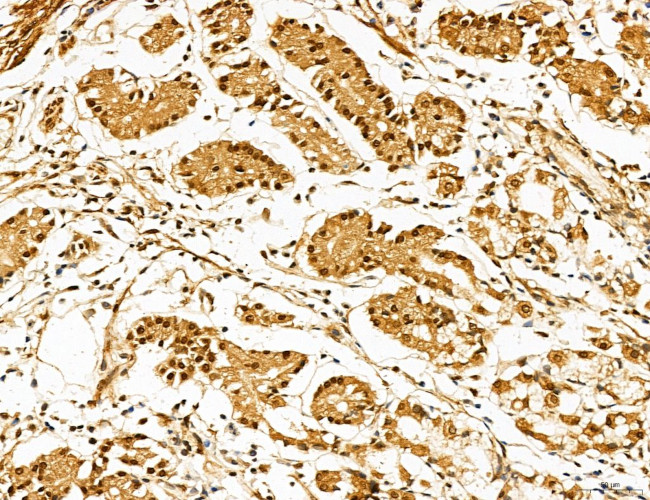 Lass2 Antibody in Immunohistochemistry (Paraffin) (IHC (P))