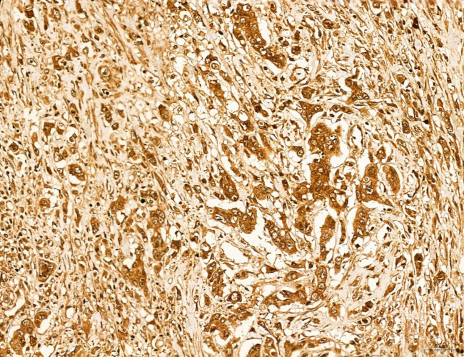 Lass2 Antibody in Immunohistochemistry (Paraffin) (IHC (P))