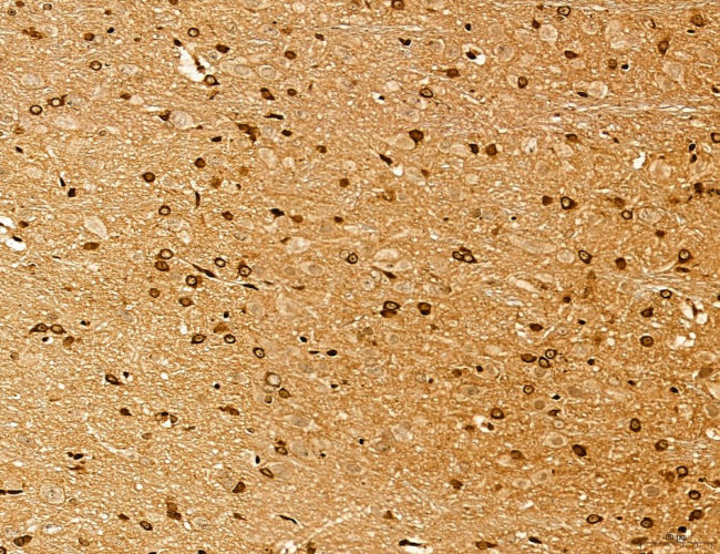 Lass2 Antibody in Immunohistochemistry (Paraffin) (IHC (P))