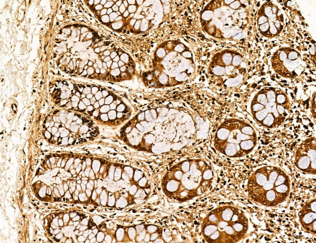 Lass2 Antibody in Immunohistochemistry (Paraffin) (IHC (P))