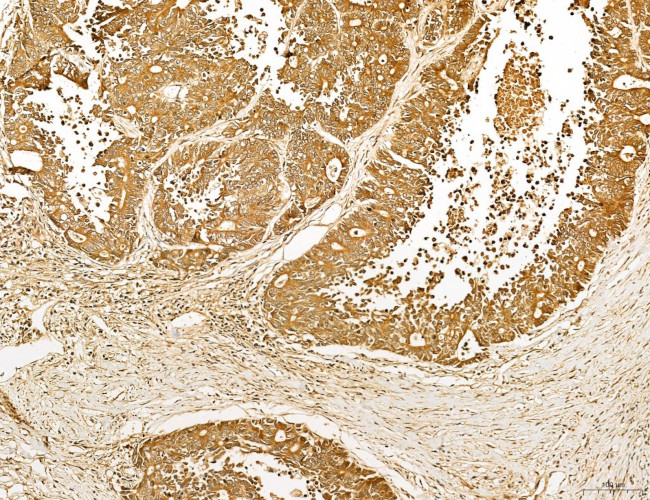 Lass2 Antibody in Immunohistochemistry (Paraffin) (IHC (P))