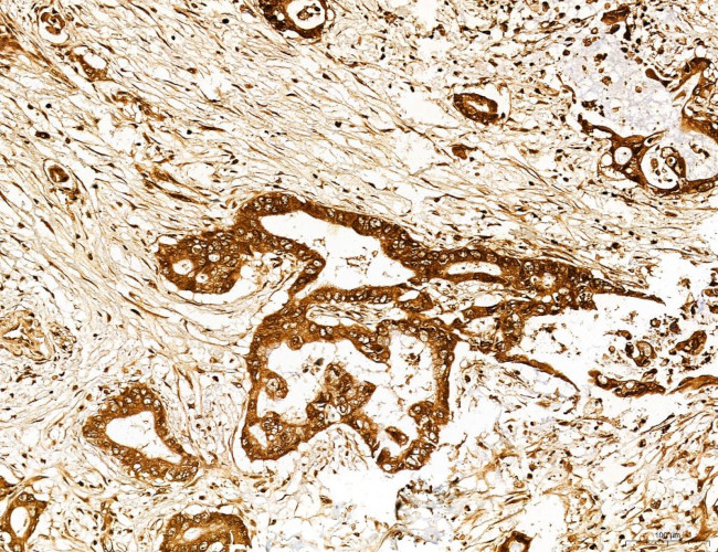 Lass2 Antibody in Immunohistochemistry (Paraffin) (IHC (P))