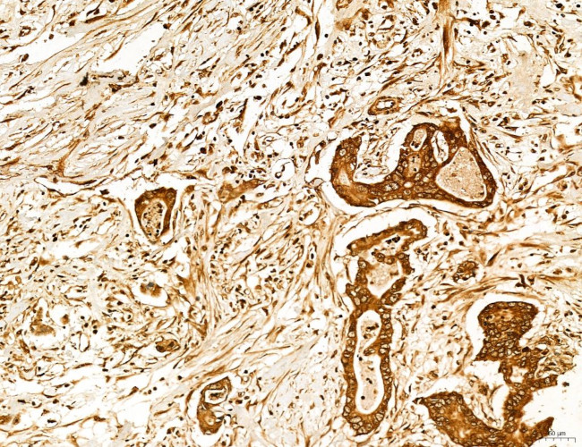 Lass2 Antibody in Immunohistochemistry (Paraffin) (IHC (P))