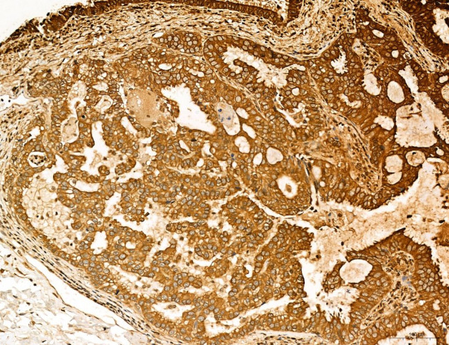 Lass2 Antibody in Immunohistochemistry (Paraffin) (IHC (P))