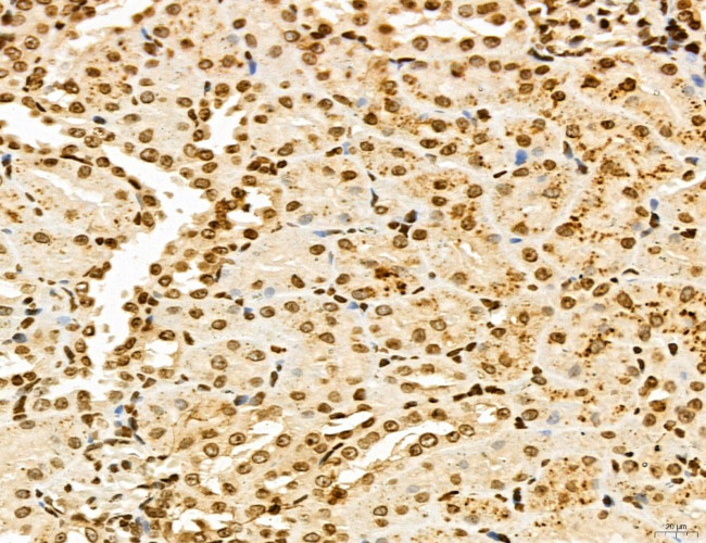 Lass2 Antibody in Immunohistochemistry (Paraffin) (IHC (P))