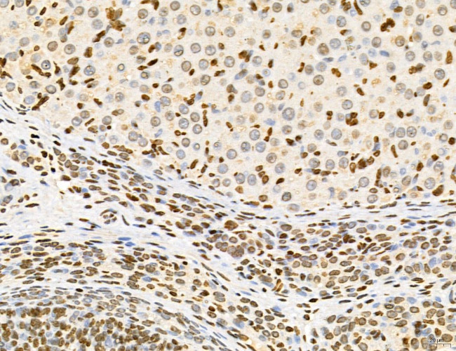 Lass2 Antibody in Immunohistochemistry (Paraffin) (IHC (P))