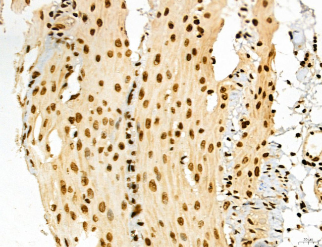 Lass2 Antibody in Immunohistochemistry (Paraffin) (IHC (P))