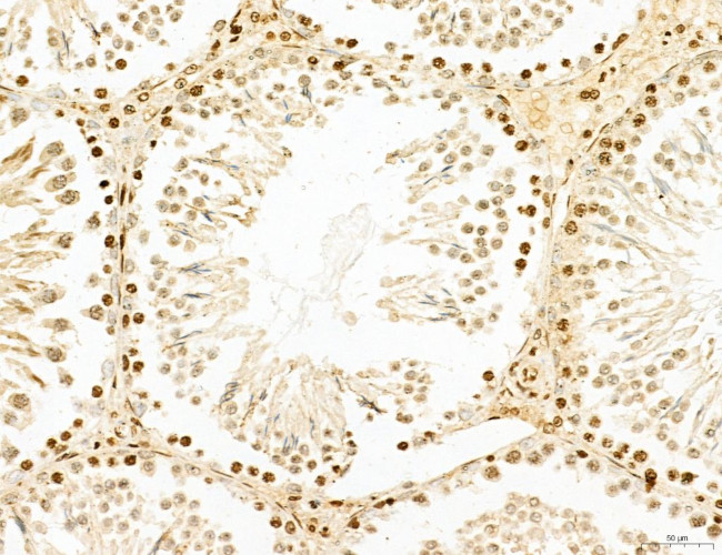 Lass2 Antibody in Immunohistochemistry (Paraffin) (IHC (P))