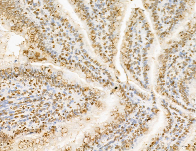 Lass2 Antibody in Immunohistochemistry (Paraffin) (IHC (P))