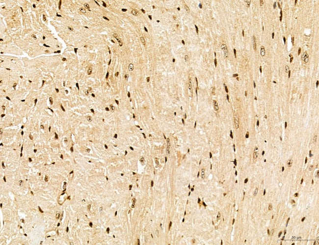 Lass2 Antibody in Immunohistochemistry (Paraffin) (IHC (P))