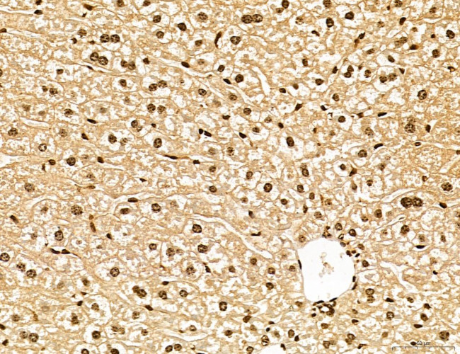 Lass2 Antibody in Immunohistochemistry (Paraffin) (IHC (P))