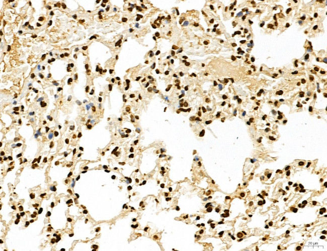 Lass2 Antibody in Immunohistochemistry (Paraffin) (IHC (P))