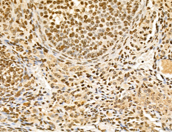 Lass2 Antibody in Immunohistochemistry (Paraffin) (IHC (P))