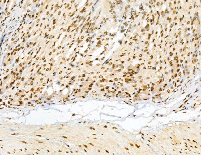 Lass2 Antibody in Immunohistochemistry (Paraffin) (IHC (P))