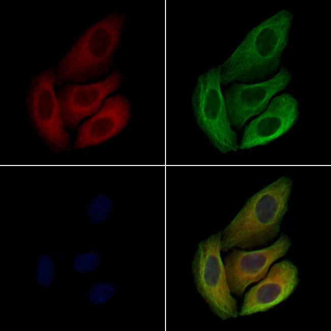 LAT Antibody in Immunocytochemistry (ICC/IF)