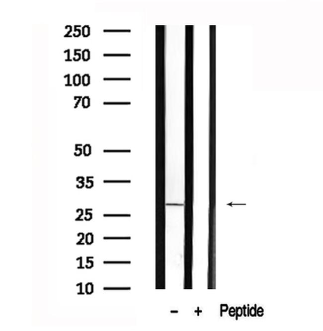 LAT Antibody in Western Blot (WB)