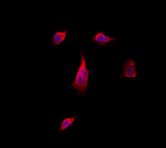 LATS1/LATS2 Antibody in Immunocytochemistry (ICC/IF)