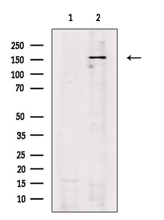 LATS1/LATS2 Antibody in Western Blot (WB)