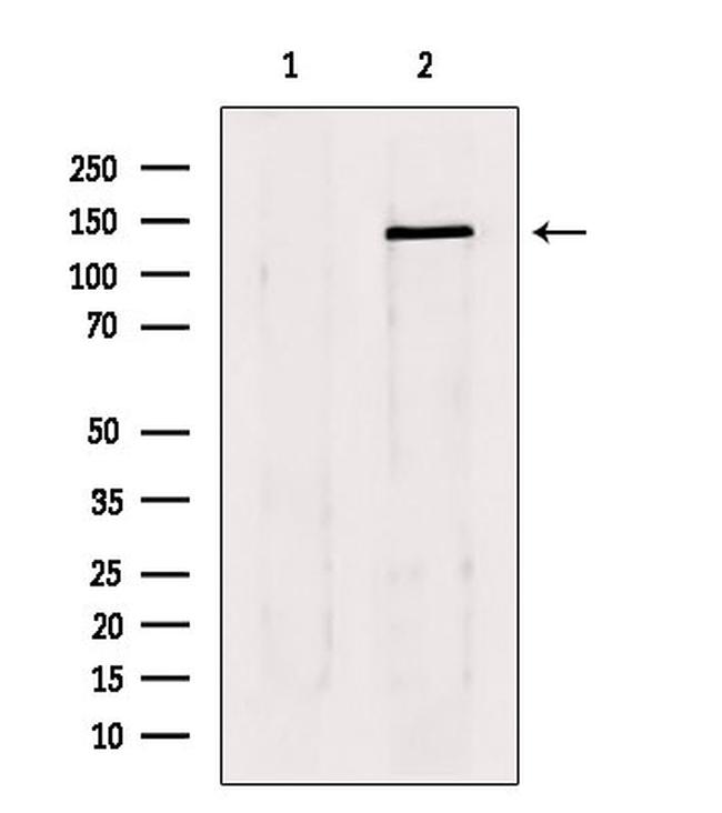 LATS1/LATS2 Antibody in Western Blot (WB)