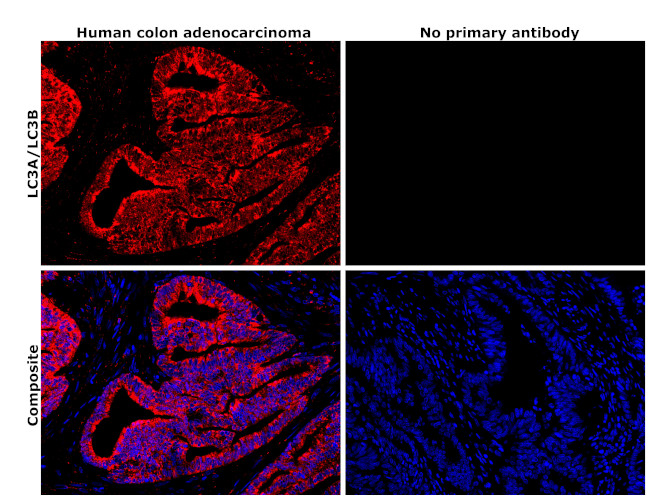 LC3A/LC3B Antibody in Immunohistochemistry (Paraffin) (IHC (P))