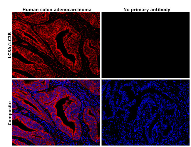 LC3A/LC3B Antibody in Immunohistochemistry (Paraffin) (IHC (P))