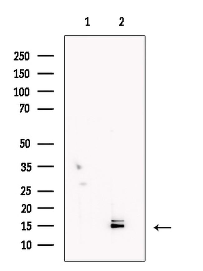 LC3A/LC3B Antibody in Western Blot (WB)