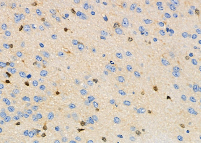 LC3B Antibody in Immunohistochemistry (Paraffin) (IHC (P))