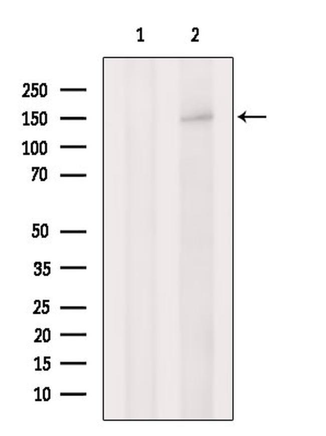 LDLR Antibody in Western Blot (WB)