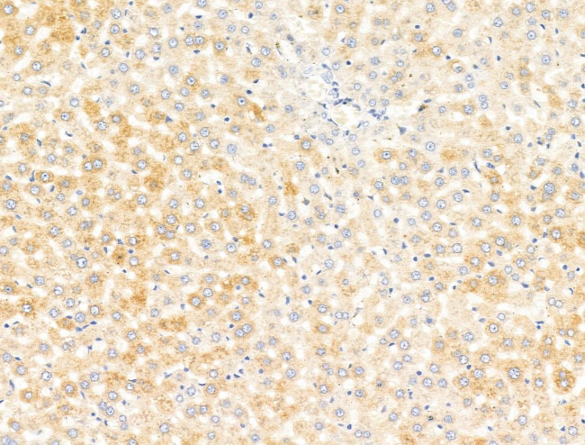 Lefty Antibody in Immunohistochemistry (Paraffin) (IHC (P))