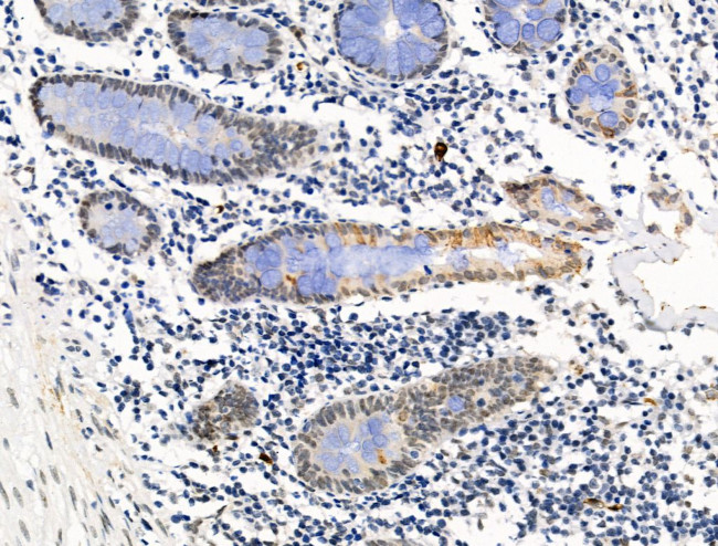 Galectin 7 Antibody in Immunohistochemistry (Paraffin) (IHC (P))