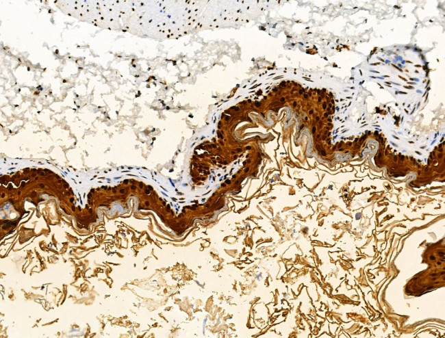 Galectin 7 Antibody in Immunohistochemistry (Paraffin) (IHC (P))