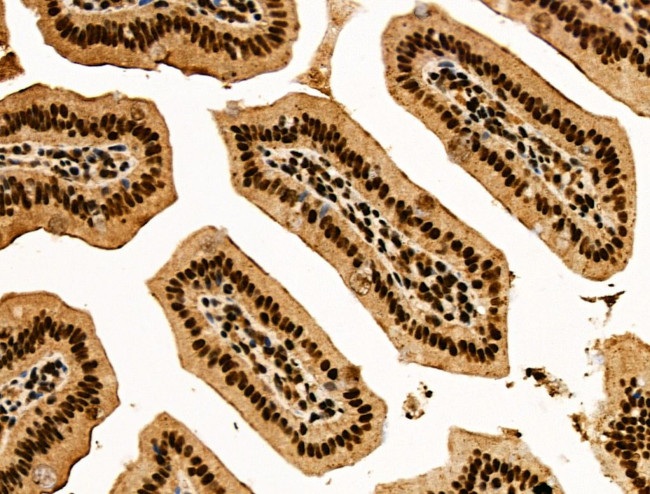 Galectin 7 Antibody in Immunohistochemistry (Paraffin) (IHC (P))