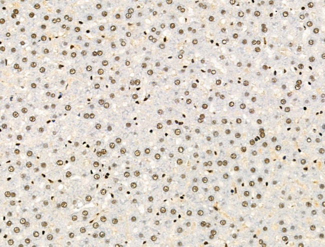 Galectin 7 Antibody in Immunohistochemistry (Paraffin) (IHC (P))