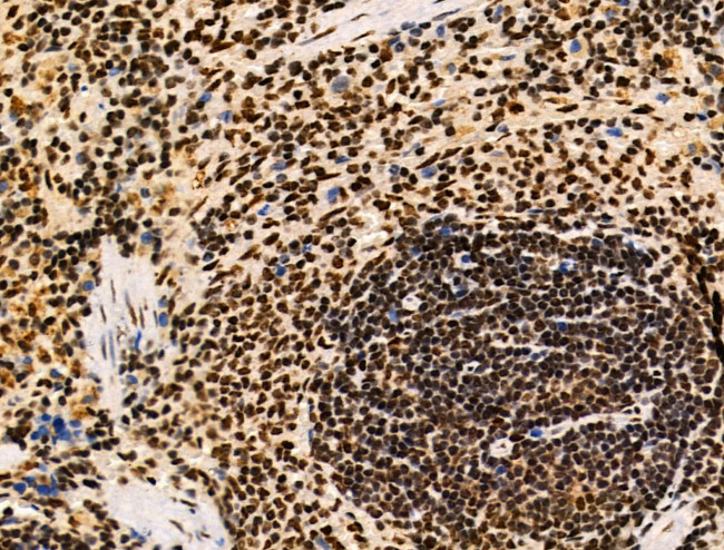 Galectin 7 Antibody in Immunohistochemistry (Paraffin) (IHC (P))