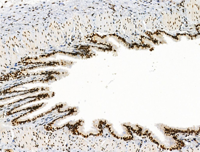 Galectin 7 Antibody in Immunohistochemistry (Paraffin) (IHC (P))