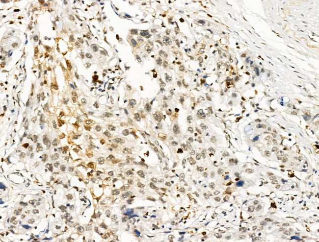 Galectin 7 Antibody in Immunohistochemistry (Paraffin) (IHC (P))