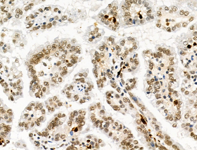 Galectin 7 Antibody in Immunohistochemistry (Paraffin) (IHC (P))